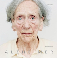 Cover: Alzheimer
